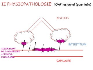 CAPILLAIRE
ALVEOLES
INTERSTITIUM
ALTERATION
DE LA BARRIERE
ALVEOLO-
CAPILLAIRE
II PHYSIOPATHOLOGIE: l’OAP lesionnel (pour info)
 