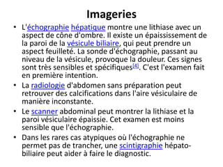 Imageries
• L'échographie hépatique montre une lithiase avec un
aspect de cône d'ombre. Il existe un épaississement de
la paroi de la vésicule biliaire, qui peut prendre un
aspect feuilleté. La sonde d'échographie, passant au
niveau de la vésicule, provoque la douleur. Ces signes
sont très sensibles et spécifiques[4]. C'est l'examen fait
en première intention.
• La radiologie d'abdomen sans préparation peut
retrouver des calcifications dans l'aire vésiculaire de
manière inconstante.
• Le scanner abdominal peut montrer la lithiase et la
paroi vésiculaire épaissie. Cet examen est moins
sensible que l'échographie.
• Dans les rares cas atypiques où l'échographie ne
permet pas de trancher, une scintigraphie hépato-
biliaire peut aider à faire le diagnostic.
 