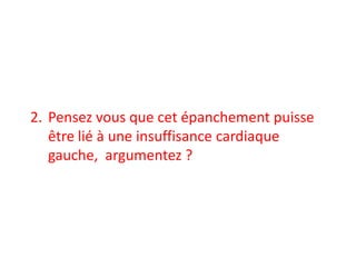 2. Pensez vous que cet épanchement puisse
être lié à une insuffisance cardiaque
gauche, argumentez ?
 