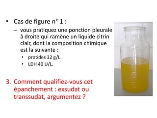 • Cas de figure n° 1 :
– vous pratiquez une ponction pleurale
à droite qui ramène un liquide citrin
clair, dont la composition chimique
est la suivante :
• protides 32 g/L
• LDH 40 U/L.
3. Comment qualifiez-vous cet
épanchement : exsudat ou
transsudat, argumentez ?
 