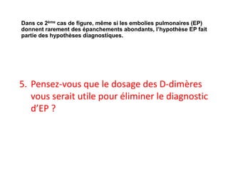5. Pensez-vous que le dosage des D-dimères
vous serait utile pour éliminer le diagnostic
d’EP ?
Dans ce 2ème cas de figure, même si les embolies pulmonaires (EP)
donnent rarement des épanchements abondants, l’hypothèse EP fait
partie des hypothèses diagnostiques.
 