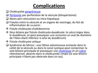 Complications
 Cholécystite gangréneuse
 Péritonite par perforation de la vésicule (biliopéritoine)
 Abcès péri-vésiculaire ou intra-hépatique
 Fistules entre la vésicule et un organe de voisinage, du fait de
inflammation de sa paroi :
 Fistule cholécysto-cholédocienne
 Iléus biliaire par fistule cholécysto-duodénale: le calcul migre dans
le duodénum, et peut provoquer une occlusion en aval (le diamètre
de l'iléon étant inférieur à celui du duodénum)
 Fistule cholécysto-colique
 Syndrome de Mirizzi : une lithise volumineuse enclavée dans le
collet de la vésicule ou dans le canal cystique peut comprimer la
voie biliaire principale et provoquer une cholestase et un ictère
rétentionnel, absents dans la cholécystite simple (la voie biliaire
principale n'étant pas obstruée dans ce cas).
 