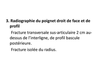 3. Radiographie du poignet droit de face et de
profil
Fracture transversale sus-articulaire 2 cm au-
dessus de l’interligne, de profil bascule
postérieure.
Fracture isolée du radius.
 