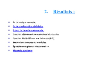 2. Résultats :
Rx thoracique normale.
Sd de condensation alvéolaire.
Foyers de broncho-pneumonie.
Opacités réticulo micro-nodulaires hilo-basales
Opacités RMN diffuses aux 2 champs (PID).
Excavations uniques ou multiples.
Épanchement pleural réactionnel ++.
Pleurésie purulente.
 