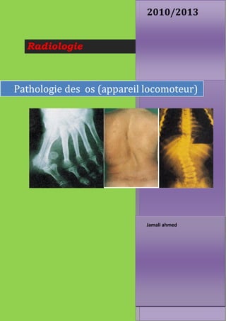 Radiologie
2010/2013
Jamali ahmed
Pathologie des os (appareil locomoteur)
 