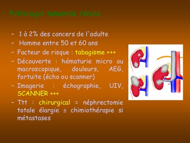 Pathologie de l_appareil_urinaire Pathologie de l_appareil_urinaire