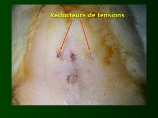 Réducteurs de tensions
 