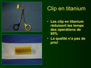 Clip en titanium

• Les clip en titanium
  réduisent les temps
  des operations de
  95%
• La qualité n’a pas de
  prix!
 