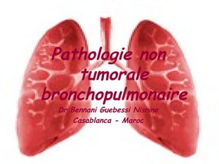 Pathologie non tumorale bronchopulmonaire Dr Bennani Guebessi Nisrine Casablanca - Maroc 