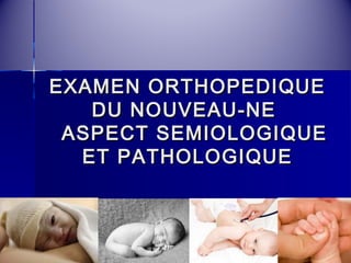 EEXXAAMMEENN OORRTTHHOOPPEEDDIIQQUUEE 
DDUU NNOOUUVVEEAAUU--NNEE 
AASSPPEECCTT SSEEMMIIOOLLOOGGIIQQUUEE 
EETT PPAATTHHOOLLOOGGIIQQUUEE 
 