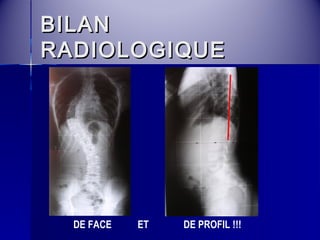 BBIILLAANN 
RRAADDIIOOLLOOGGIIQQUUEE 
DE FACE ET DE PROFIL !!! 
 
