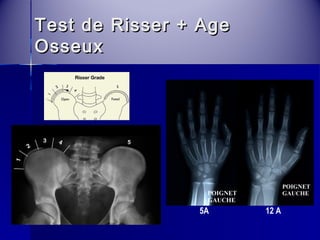 Test ddee RRiisssseerr ++ AAggee 
OOsssseeuuxx 
5A 12 A 
 