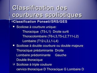 CCllaassssiiffiiccaattiioonn ddeess 
ccoouurrbbuurreess ssccoolliioottiiqquueess 
Classification Ponseti/SRS/GES 
 SSccoolliioossee àà ccoouurrbbuurree uunniiqquuee:: 
TThhoorraacciiqquuee ((TT55--LL11)) DDrrooiittee ssuurrtttt 
TThhoorraaccoolloommbbaaiirree ((TT66--LL33,,TT55--LL22,,TT1111--LL22)) 
LLoommbbaaiirree ((TT1122--LL33,,LL11--LL4)) 
 SSccoolliioossee àà ddoouubbllee ccoouurrbbuurree oouu ddoouubbllee mmaajjeeuurree 
TThhoorraacciiqquuee pprrééddoommiinnaannttee DDrrooiittee 
LLoommbbaaiirree pprrééddoommiinnaannttee GGaauucchhee 
DDoouubbllee tthhoorraacciiqquuee 
 SSccoolliioossee àà ttrriippllee ccoouubbuurree 
cceerrvviiccoo tthhoorraacciiqquuee DD TThhoorraacciiqquuee GG LLoommbbaaiirree DD 
 