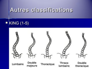 Autres ccllaassssiiffiiccaattiioonnss 
 KKIINNGG ((11--55)) 
 