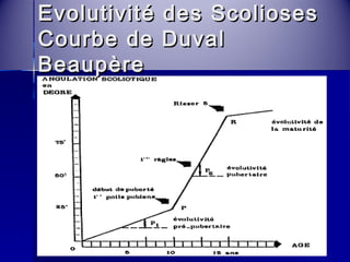 Evolutivité ddeess SSccoolliioosseess 
CCoouurrbbee ddee DDuuvvaall 
BBeeaauuppèèrree 
 
