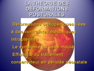 LLAA TTHHEEOORRIIEE DDEESS 
DDEEFFOORRMMAATTIIOONNSS 
PPOOSSTTUURRAALLEESS 
DDééffoorrmmaattiioonnss oorrtthhooppééddiiqquueess lliiééeess 
àà ddeess ccoonnttrraaiinntteess mmééccaanniiqquueess 
iinnttrraauuttéérriinneess 
LLee ssyynnddrroommee dduu bbéébbéé mmoouulléé 
EEffffiiccaacciittéé dduu ttrraaiitteemmeenntt 
ccoonnsseerrvvaatteeuurr eenn ppéérriiooddee nnééoonnaattaallee 
 
