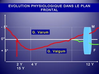 - 5° 
0° 
+ 5° 
EVOLUTION PHYSIOLOGIQUE DANS LE PLAN 
FRONTAL 
G. Varum 
G. Valgum 
M 
F 
2 Y 4 Y 12 Y 
15 Y 
 