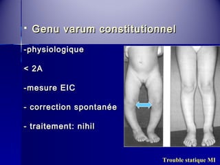  Genu varum ccoonnssttiittuuttiioonnnneell 
--pphhyyssiioollooggiiqquuee 
<< 22AA 
--mmeessuurree EEIICC 
-- ccoorrrreeccttiioonn ssppoonnttaannééee 
-- ttrraaiitteemmeenntt:: nniihhiill 
Trouble statique MI 
 