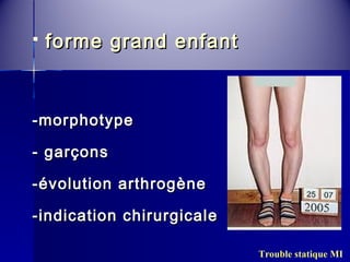  ffoorrmmee ggrraanndd eennffaanntt 
--mmoorrpphhoottyyppee 
-- ggaarrççoonnss 
--éévvoolluuttiioonn aarrtthhrrooggèènnee 
--iinnddiiccaattiioonn cchhiirruurrggiiccaallee 
Trouble statique MI 
 