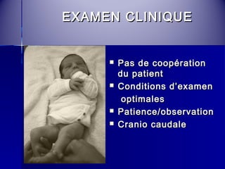 EEXXAAMMEENN CCLLIINNIIQQUUEE 
 PPaass ddee ccooooppéérraattiioonn 
dduu ppaattiieenntt 
 CCoonnddiittiioonnss dd’’eexxaammeenn 
ooppttiimmaalleess 
 PPaattiieennccee//oobbsseerrvvaattiioonn 
 CCrraanniioo ccaauuddaallee 
 