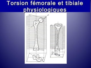 Torsion fémorale eett ttiibbiiaallee 
pphhyyssiioollooggiiqquueess 
 