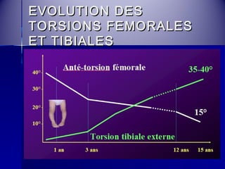 EEVVOOLLUUTTIIOONN DDEESS 
TTOORRSSIIOONNSS FFEEMMOORRAALLEESS 
EETT TTIIBBIIAALLEESS 
 