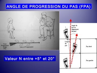 ANGLE DE PROGRESSION DU PAS (FPA) 
Valeur N entre +5° et 20° 
 