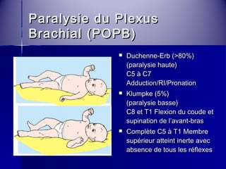 PPaarraallyyssiiee dduu PPlleexxuuss 
BBrraacchhiiaall ((PPOOPPBB)) 
 DDuucchheennnnee--EErrbb ((>>8800%%)) 
((ppaarraallyyssiiee hhaauuttee)) 
CC55 àà CC77 
AAdddduuccttiioonn//RRII//PPrroonnaattiioonn 
 KKlluummppkkee ((55%%)) 
((ppaarraallyyssiiee bbaassssee)) 
CC88 eett TT11 FFlleexxiioonn dduu ccoouuddee eett 
ssuuppiinnaattiioonn ddee ll’’aavvaanntt--bbrraass 
 CCoommppllèèttee CC55 àà TT11 MMeemmbbrree 
ssuuppéérriieeuurr aatttteeiinntt iinneerrttee aavveecc 
aabbsseennccee ddee ttoouuss lleess rrééfflleexxeess 
 