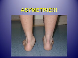 AASSYYMMEETTRRIIEE!!!!!! 
 