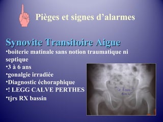 Pièges et signes d’alarmes 
SSyynnoovviittee TTrraannssiittooiirree AAiigguuee 
•boiterie matinale sans notion traumatique ni 
septique 
•3 à 6 ans 
•gonalgie irradiée 
•Diagnostic échoraphique 
•! LEGG CALVE PERTHES 
•tjrs RX bassin 
 
