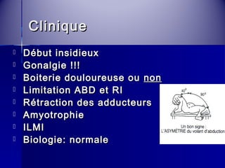 CClliinniiqquuee 
 DDéébbuutt iinnssiiddiieeuuxx 
 GGoonnaallggiiee !!!!!! 
 BBooiitteerriiee ddoouulloouurreeuussee oouu nnoonn 
 LLiimmiittaattiioonn AABBDD eett RRII 
 RRééttrraaccttiioonn ddeess aadddduucctteeuurrss 
 AAmmyyoottrroopphhiiee 
 IILLMMII 
 BBiioollooggiiee:: nnoorrmmaallee 
 