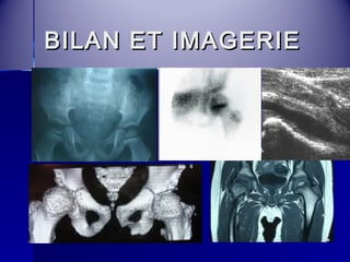 BBIILLAANN EETT IIMMAAGGEERRIIEE 
 