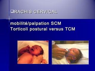 RRAACCHHIISS CCEERRVVIICCAALL 
mmoobbiilliittéé//ppaallppaattiioonn SSCCMM 
TToorrttiiccoollii ppoossttuurraall vveerrssuuss TTCCMM 
 