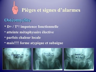 Pièges et signes d’alarmes 
OOssttééoommyyéélliittee 
• D+ / T°/ impotence fonctionnelle 
• atteinte métaphysaire élective 
• parfois chaleur locale 
• mais!!!! forme atypique et subaigue 
 