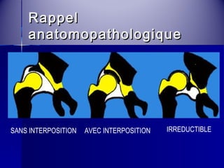 RRaappppeell 
aannaattoommooppaatthhoollooggiiqquuee 
SANS INTERPOSITION AVEC INTERPOSITION IRREDUCTIBLE 
 