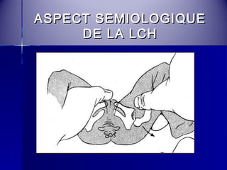 AASSPPEECCTT SSEEMMIIOOLLOOGGIIQQUUEE 
DDEE LLAA LLCCHH 
 