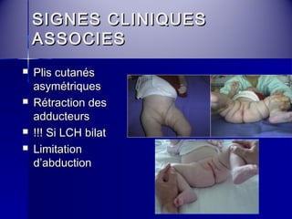 SSIIGGNNEESS CCLLIINNIIQQUUEESS 
AASSSSOOCCIIEESS 
 PPlliiss ccuuttaannééss 
aassyymmééttrriiqquueess 
 RRééttrraaccttiioonn ddeess 
aadddduucctteeuurrss 
 !!!!!! SSii LLCCHH bbiillaatt 
 LLiimmiittaattiioonn 
dd’’aabbdduuccttiioonn 
 