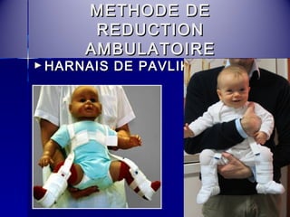 MMEETTHHOODDEE DDEE 
RREEDDUUCCTTIIOONN 
AAMMBBUULLAATTOOIIRREE 
►HHAARRNNAAIISS DDEE PPAAVVLLIIKK 
 