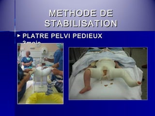 MMEETTHHOODDEE DDEE 
SSTTAABBIILLIISSAATTIIOONN 
► PPLLAATTRREE PPEELLVVII PPEEDDIIEEUUXX 
33mmooiiss 
 