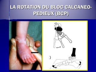 LLAA RROOTTAATTIIOONN DDUU BBLLOOCC CCAALLCCAANNEEOO-- 
PPEEDDIIEEUUXX ((BBCCPP)) 
 