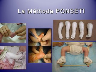 LLaa MMéétthhooddee PPOONNSSEETTII 
 