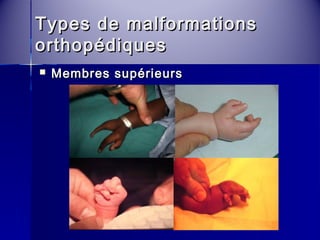 Types ddee mmaallffoorrmmaattiioonnss 
oorrtthhooppééddiiqquueess 
 MMeemmbbrreess ssuuppéérriieeuurrss 
 