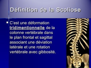 Définition ddee llaa SSccoolliioossee 
 CC’’eesstt uunnee ddééffoorrmmaattiioonn 
ttrriiddiimmeennttiioonnnneellllee ddee llaa 
ccoolloonnnnee vveerrttéébbrraallee ddaannss 
llee ppllaann ffrroonnttaall eett ssaaggiittttaall 
aassssoocciiaanntt uunnee ddéévviiaattiioonn 
llaattéérraallee eett uunnee rroottaattiioonn 
vveerrttéébbrraallee aavveecc ggiibbbboossiittéé.. 
 