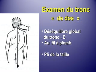 CC77 
EE 
EExxaammeenn dduu ttrroonncc 
« ddee ddooss »
• DDééssééqquuiilliibbrree gglloobbaall 
dduu ttrroonncc :: EE 
• AAuu ffiill àà pplloommbb 
• PPllii ddee llaa ttaaiillllee 
 