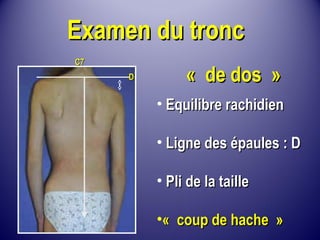 EExxaammeenn dduu ttrroonncc 
• EEqquuiilliibbrree rraacchhiiddiieenn 
• LLiiggnnee ddeess ééppaauulleess :: DD 
• PPllii ddee llaa ttaaiillllee 
•« ccoouupp ddee hhaacchhee » 
CC77 
DD « ddee ddooss »
 
