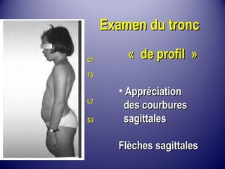 CC77 
TT55 
LL22 
SS33 
EExxaammeenn dduu ttrroonncc 
« ddee pprrooffiill » 
• AApppprréécciiaattiioonn 
ddeess ccoouurrbbuurreess 
ssaaggiittttaalleess 
FFllèècchheess ssaaggiittttaalleess 
 