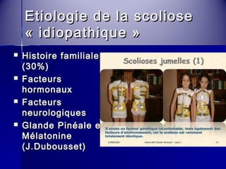 Etiologie ddee llaa ssccoolliioossee 
« iiddiiooppaatthhiiqquuee » 
 HHiissttooiirree ffaammiilliiaallee 
((3300%%)) 
 FFaacctteeuurrss 
hhoorrmmoonnaauuxx 
 FFaacctteeuurrss 
nneeuurroollooggiiqquueess 
 GGllaannddee PPiinnééaallee eett 
MMééllaattoonniinnee 
((JJ..DDuubboouusssseett)) 
 