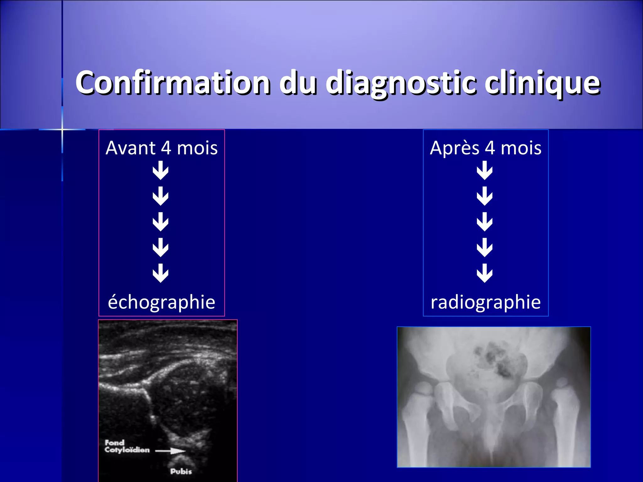 Pack ORTHOKÉRATOLOGIE 6 mois + main image 1