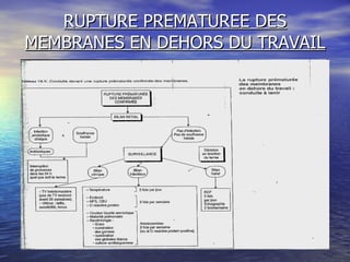 RUPTURE PREMATUREE DES MEMBRANES EN DEHORS DU TRAVAIL 