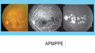 Pathologies in ffa | PPTX